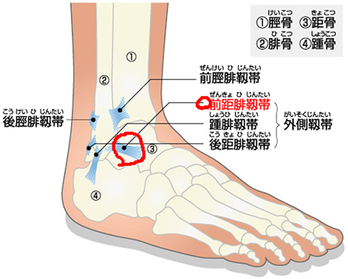 捻挫について